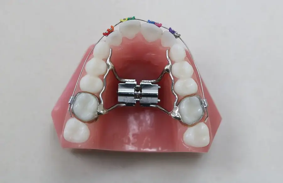 metal braces with rainbow bands